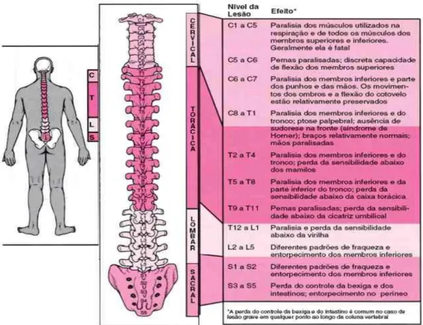 Figura 1 – Nível da LVM e comprometimento.  