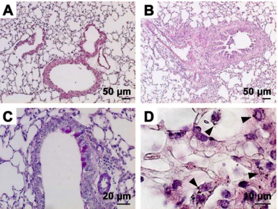 Figure 6. Histopathological findings of the lungs after exposure to PM. Paraffin-embedded sections were stained with hematoxylin-eosin for the saline control (A) and Sup plus Pre (B)