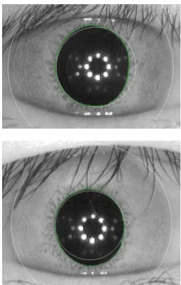 Fig. 4  Iris images segmented with circular approximation in white  contour and with active contour in green contour