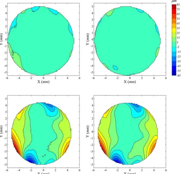 Fig 4. Distribution of elevation difference between successive corneal topographies before and after correction for misalignment: Case 2