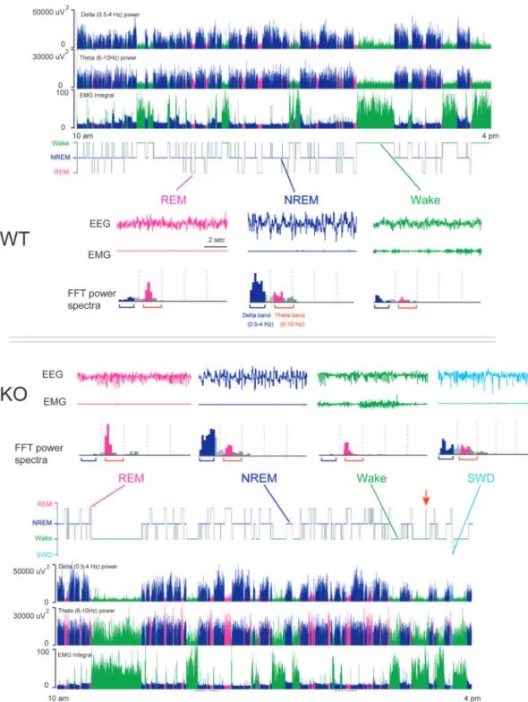 Figure 1. GAT1 KO mice displayed abnormal EEG activity. Representative examples for hypnogram, FFT-derived delta (0.5–4 Hz) power, FFT- FFT-derived theta (6–10 Hz) power and EMG activity in a WT (above) and KO mouse (below) from 10 am to 4 pm, as well as t