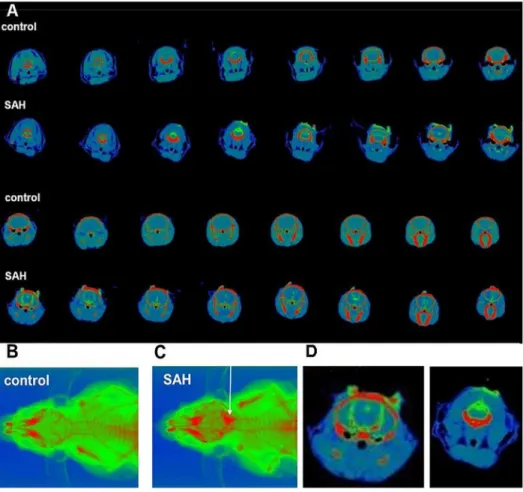 Fig. 1. Micro CT and X-Ray imaging of cisterna magna injection. A: micro CT images (HU range 2 200 to 1200) collected before (control) and immediately after injection of a 1:1 mixture of blood and the contrast agent Imerone 400 (SAH)