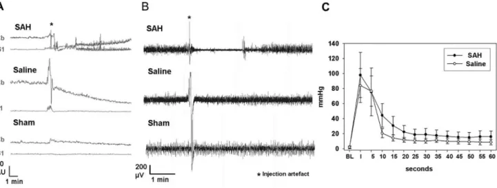 Fig. 2. Acute effects on perfusion, cortical signaling and ICP. A: sample traces of rCBF of the three experimental groups immediately after injection