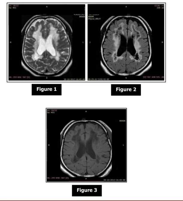 Figure 1  Figure 2 