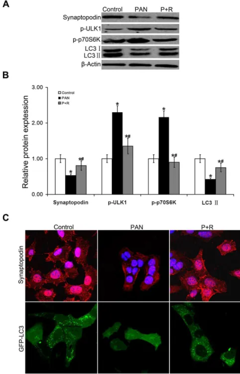 Figure 4. Podocyte injury and activation of the mTOR-ULK1 pathway. (A-B).Western blot analysis of cellular proteins confirmed that the most significant upregulated expression of mTOR signaling pathway-associated proteins was observed in 2 h puromycin amino