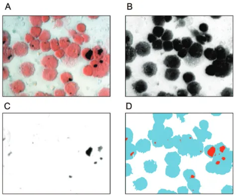 Fig 1. Particulate burden is measured by the percentage of macrophage cytoplasm taken up with particulate matter as calculated by digital image analysis of light microscopy images