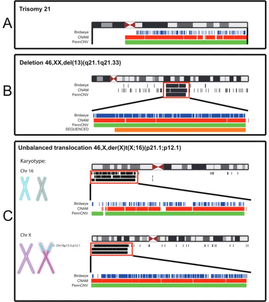 Figure 2. Detection of large-scale genomic variants with CNAM, PennCNV and Birdseye and the Affymetrix SNP Array 6.0