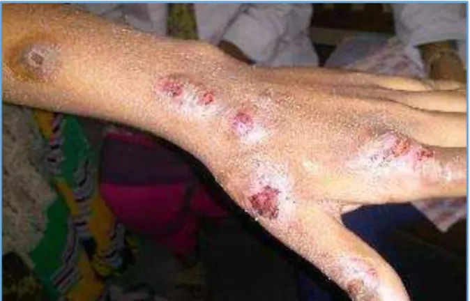 Fig.  : Pre - Treatment