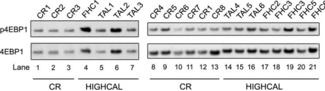 Figure 4 displays the frequencies (at both permissive and restrictive cutoffs) of each of four classes of genes: increased by CR and more highly expressed (UP) in females, increased by CR and UP in males, decreased by CR and displaying lower expression (DO