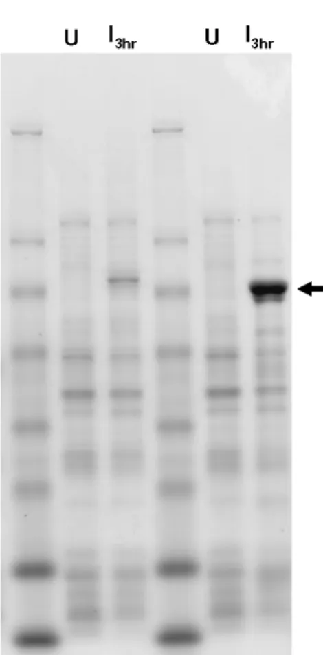 Figure 6. Evaluation of expression levels for the E. coli codon optimized LSA-NRC E (3D7) and full gene codon harmonized LSA-NRC H (3D7)