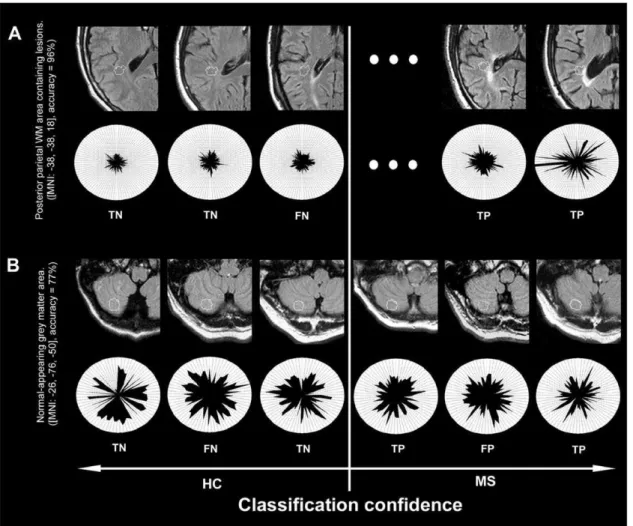 Figure 3 shows native TIRM image features used by pattern classifiers for this coordinate