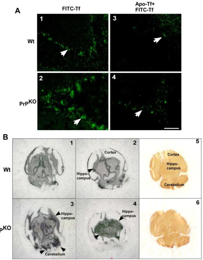 Figure 2. Brain sections of PrP KO mice show up regulation of TfR and increased transport of iron from the blood stream