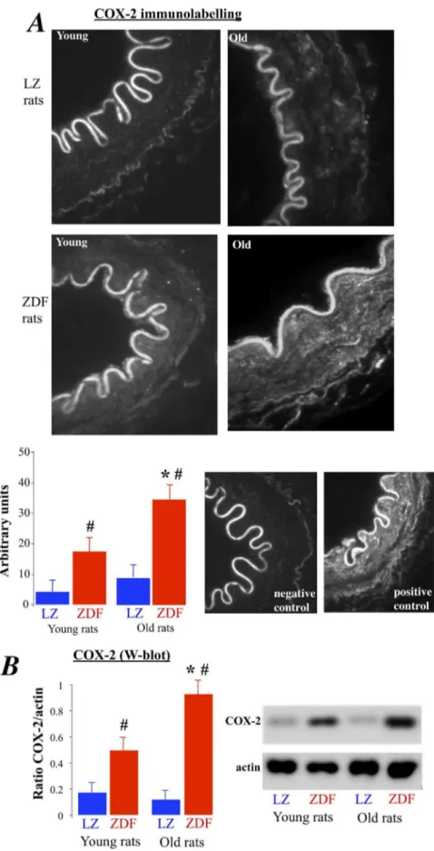 Figure 4. Measurement of COX-2 expression level in mesenteric resistance arteries isolated from young and old LZ and ZDF rats using immunolabelling (A) and Western-blot analysis (B)