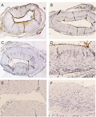 Figure S1 Comparative immunostaining of a liver biopsy of a non-Z patient with chronic  myeloprolifera-tive disorder and hepatic blood formation