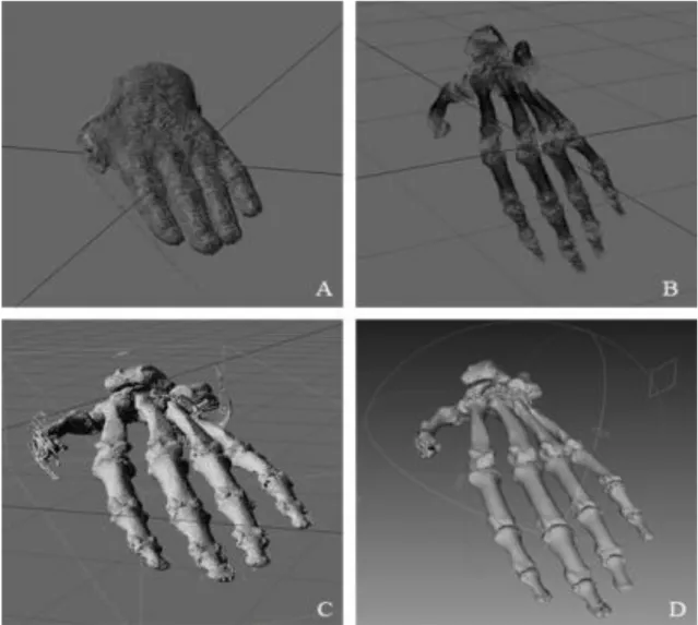 Figure 9- Skin and Bone Tissue density differentiation obtained through black and white gradients, with Lightwave