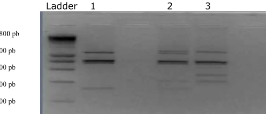 Figure 4. The electrophoretic profile of the PCR product digested with 1 µl Sau 3A I. 