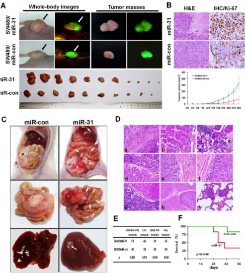Figure 3.  miR-31 enhanced tumor growth, invasion and metastasis in vivo.  (A) External whole-body fluorescence images of SW480/miR-31 and SW480/miR-con mice and tumors (upper) and images of subcutaneous tumor of mice (lower) were obtained.