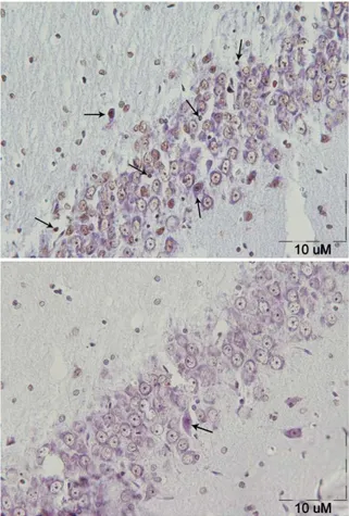 Figure  1. TUNEL staining  in rat’s  hippocampus  of  chronic  noise  exposure  group(right  photomicrograph)  and  control  group(left  photomicrograph)