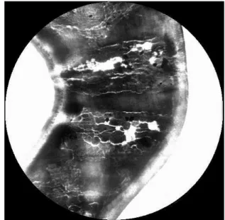 Figure 4. A seemingly intact thyroid shield, which  appeared to be defected in the X-ray examination 
