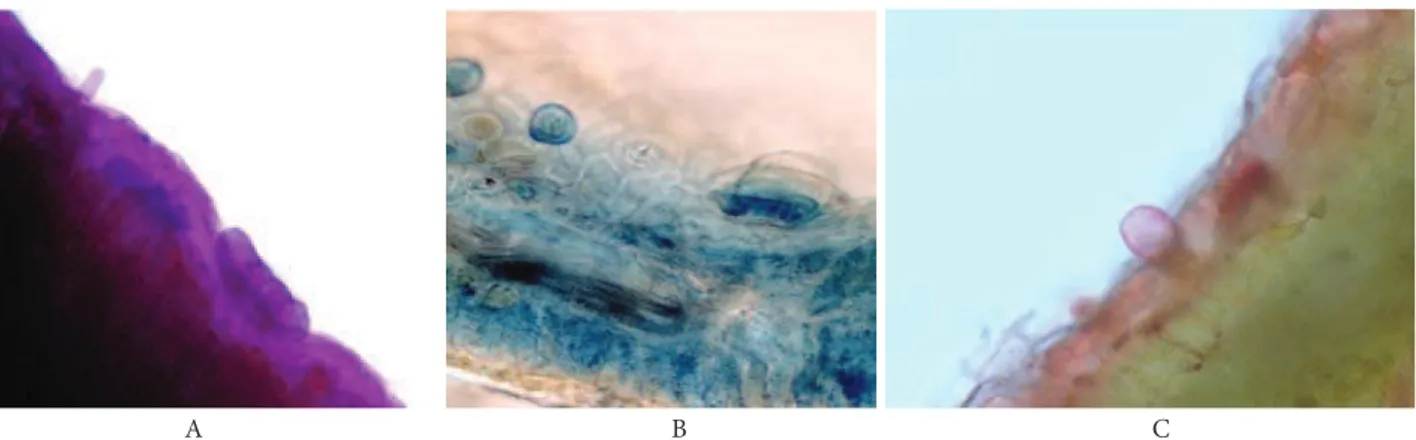 Fig. 4. Histochemical characterization of the secretions of Satureja horvatii glandular trichomes.