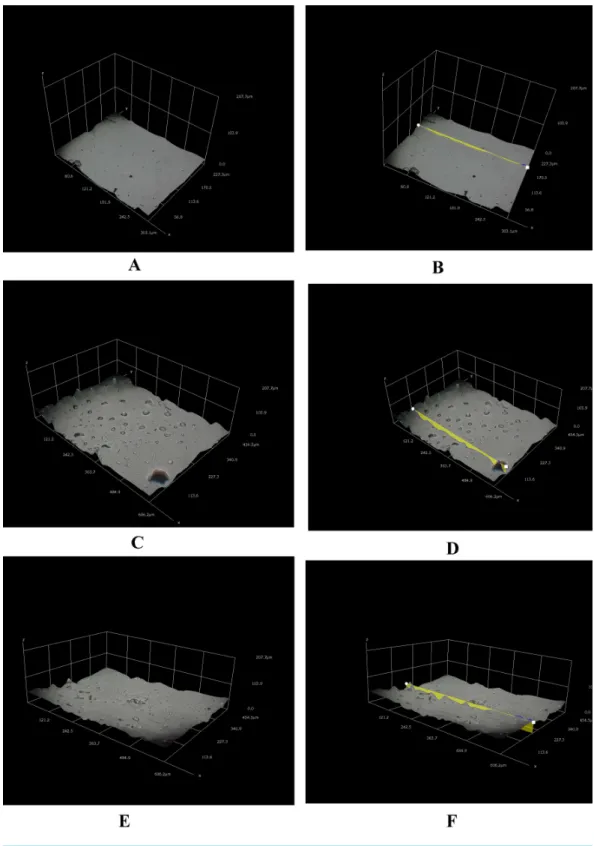 Figure 3 Different three-dimensional representations using 3D Hirox digital microscopy