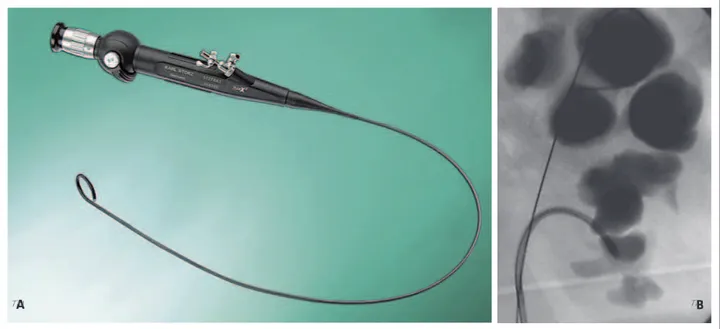 Abbildung 2: (A) Flexibles Ureterorenoskop, Flex x-X 2 TM . Mit freundlicher Genehmigung von KARL STORZ GmbH &amp; Co