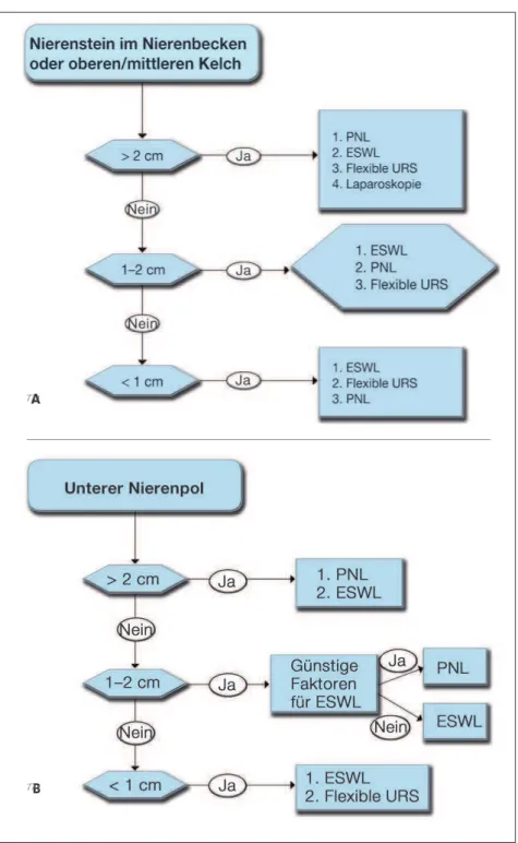 Abbildung 4: (A) Behandlungsalgorithmus für Nierensteine im Nierenbecken oder in den oberen und mittleren Kelchen