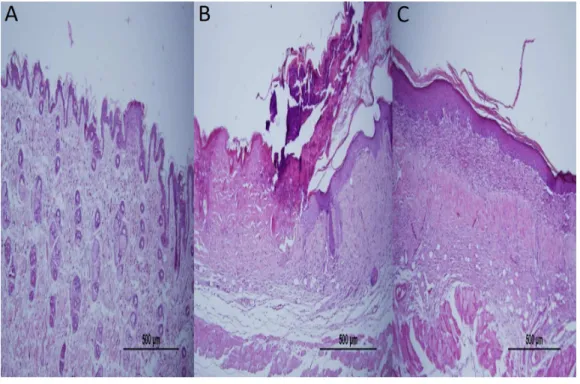 Figure 3 Representative H&amp;E staining of skin tissues in groups after 1-week treatment