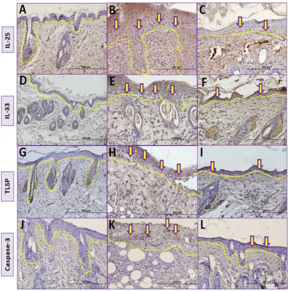 Figure 5 Comparison ofimmunohistochemical analysis between groups. (A, D, G, J) Control group;