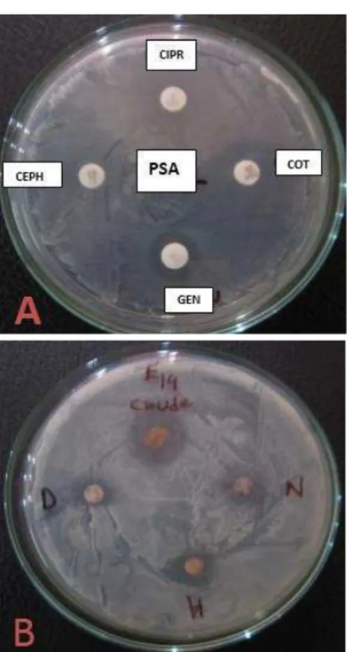 Figure  5.  (A)  Different  antimicrobial  discs.  (B)  Fresh  and  dried  crude  zone  against  E