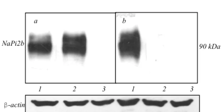 Fig. 1.  Western blot  analysis of  HEK293  cells  expressing  wild  type NaPi2b (1), mutant form NaPi2b_T330V (2) and cells transfected with empty  pcDNA3.1(+)  vector  (3)  by  anti-EE-tag  (a)  and  MX35  (b) antibodies; b-actin was used as a loading co