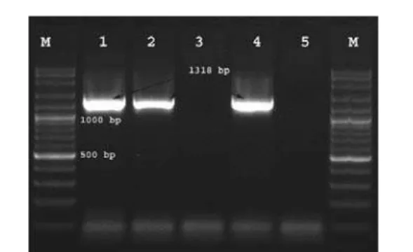 Figure 1. Results of simplex PCR from milk samples  with  S. aureus specific primers. M: 100bp plus marker