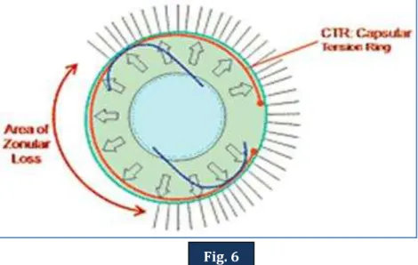 Fig. 6 Fig. 5 