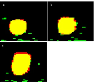 Figure 5. Differences between ITV true  and ITV measured  obtained  by x+3×SD  with the maximum distances of A) 10.9 mm, B)  21.8 mm and C) 43.7 mm