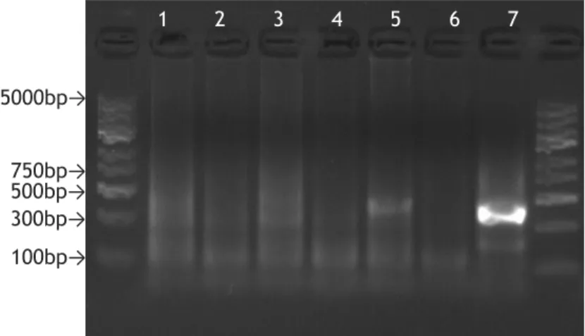 Figure  4-  Agarose  gel  (1.5%)  electrophoresis,  stained  with  GelRed,  of  the  PCR  products  obtained with B+Mx condition: 1-Sample 1, 2-Sample 2, 3-Sample 3, 4-Sample 4, 5-Sample 5,  6-Negative control, 7-Positive control