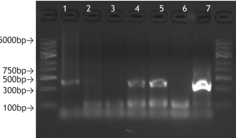 Figure  6-  Agarose  gel  (1.5%)  electrophoresis,  stained  with  GelRed,  of  the  PCR  products  obtained with  DNA+Mx condition: 1-Sample 1, 2-Sample 2, 3-Sample 3, 4-Sample 4, 5-Sample  5, 6-Negative control, 7-Positive control