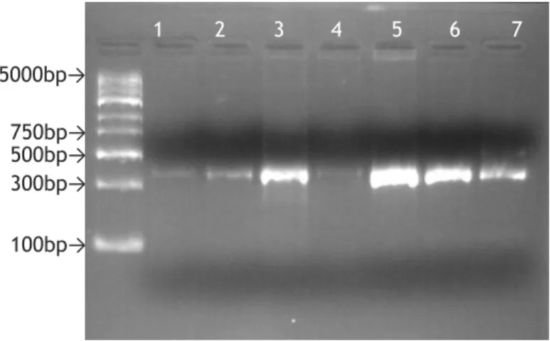 Figure 10- Agarose gel (1.5%) electrophoresis, stained with GelRed, of the PCR products  obtained with DNA+16S condition: 1-Sample 1, 2-Sample 2, 3-Sample 3, 4-Sample 4, 5-Sample  5, 6-Negative control, 7-Positive control