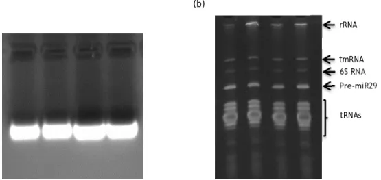 Figure  7:  Characterization  of  four  different  sRNAs  samples  extracted  form  R