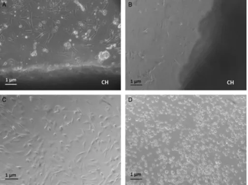 Figure 2. Photomicrographs of fibro- fibro-blast cells from rat skin after being seeded on chitosan hydrogel (CH)  af-ter 24 hours (A) and 3 days (B);  poly-styrene (C); and polypoly-styrene with ethanol 96% (D)