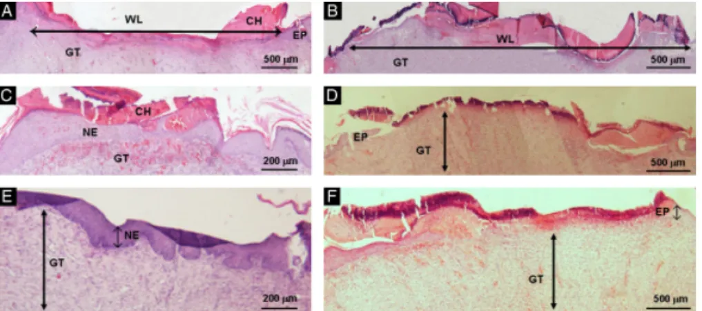 Figure 8. Hematoxylin and eosin- eosin-stained sections of biopsies for the morphological evaluation of skin  le-sions