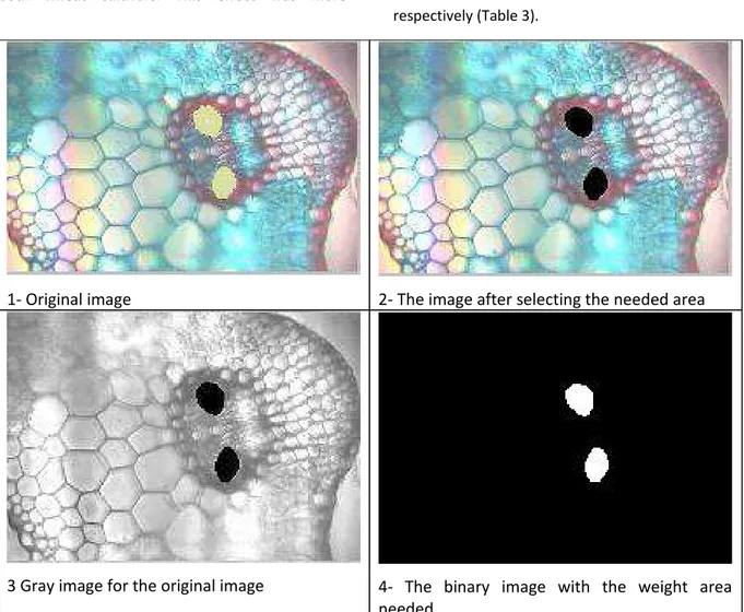 Figure 1. The image analysis steps for estimating the area of metaxylem (in microns) for flag leaf of   droughted wheat cultivars
