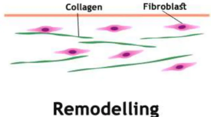 Figure  9:  Representation  of  the  remodeling  phase.  The  green  represents  collagen  and  the  purple  fibroblasts