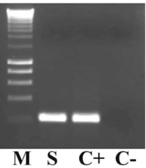 Fig. 1. Direct microscopic indings of amastigotes of Leishmania spp. in bone marrow (BM) smear Giemsa-stained (500-1000x)