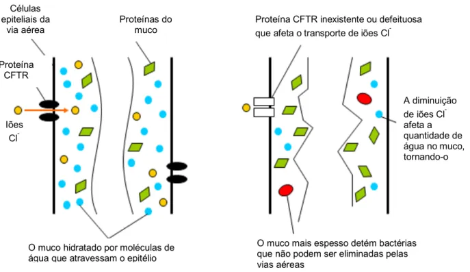 Figura 1 – Espessamento do muco das vias aéreas devido ao mau funcionamento da proteína CFTR