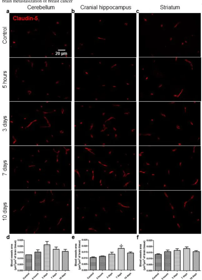 Fig. 8 Microvascular density changes along the process of brain metastasization of breast  cancer