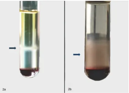 Fig 2. Blood cells fractionation on Histopaque 1.077 performed applying (a) 480g, 30 min or (b) 150g, 20 min centrifugation step, RT