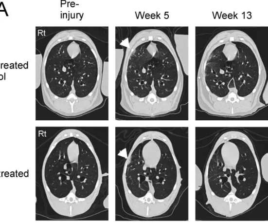 Figure 1. High resolution CT scans of the chest at baseline and then at the indicated time points after 15 Gy right lung irradiation and DS1 cell infusion