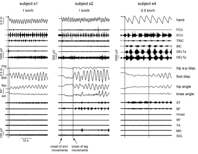 Figure 2. Stepping initiation. Examples of the delay of evoked air stepping from the onset of arm movements (at speeds indicated on the top of the figure) in three different subjects