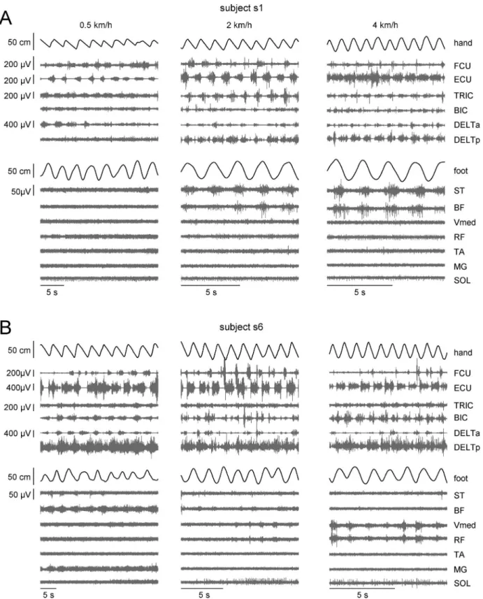 Figure 5. EMG patterns in two representative subjects for different hand-walking speeds