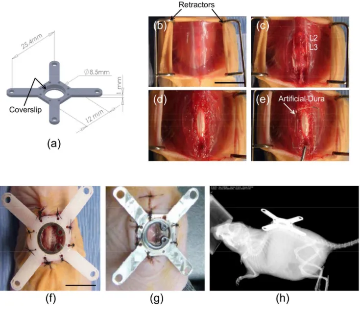 Figure 1. Mouse spinal cord window chamber (SCWC) device and surgical implantation procedures